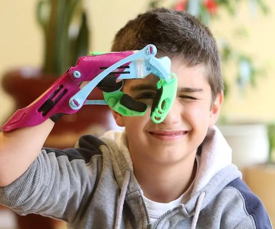 A young person smiles and looks through a colorful 3D-printed prosthesis